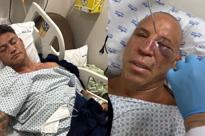 Imagens de Popó (esquerda) e Wanderlei Silva (direita), após a luta
