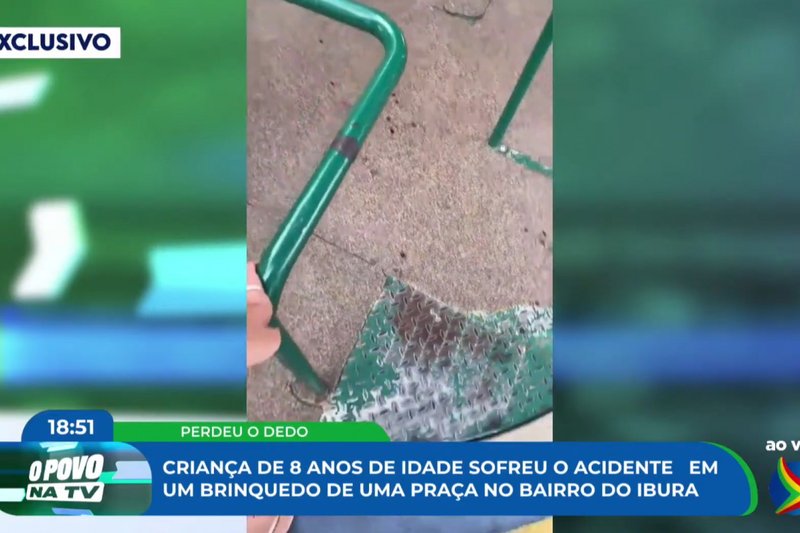 Criança se acidentou em brinquedo do Parque da Infância, no Ibura, Zona Sul do Recife