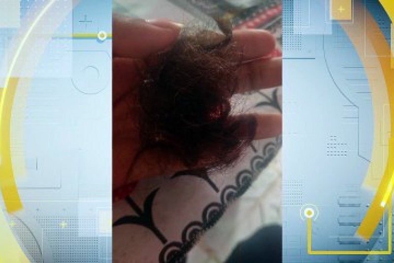 Polícia investiga recorrência de assaltos a mulheres com uso de máquina de barbear na Zona Sudoeste do Recife