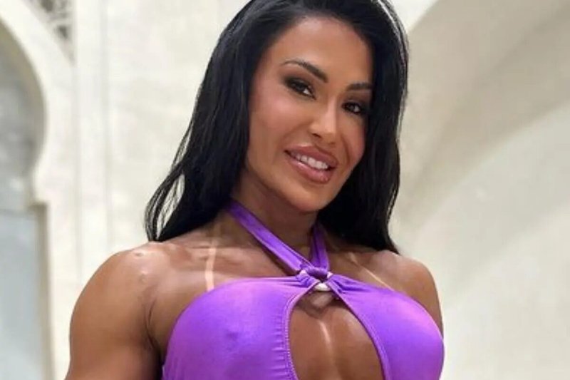 Gracyanne Barbosa relata lentidão no processo de recuperação: “Estou reaprendendo a andar”