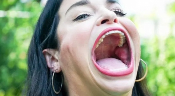 Tiktoker entra para o Guinness Book com a maior boca do mundo; veja vídeo