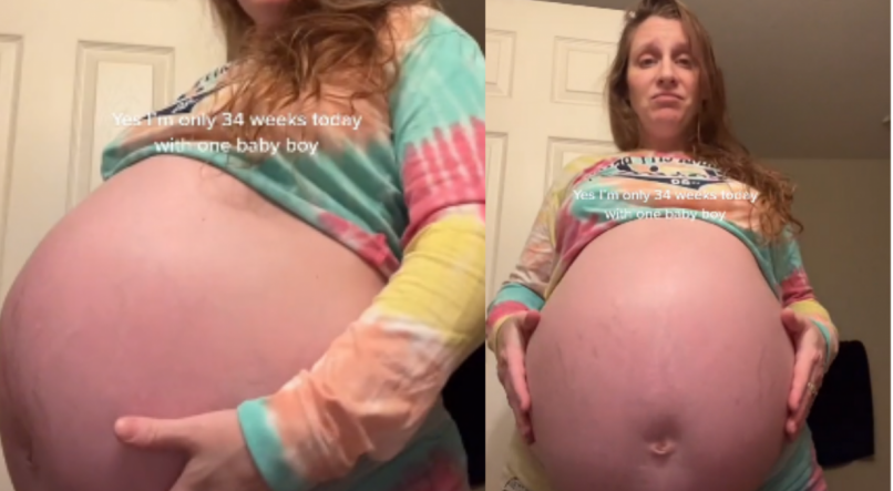Renae está grávida de 37 semanas e chocou internautas ao registrar tamanho da barriga