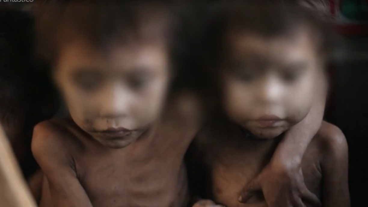 Crianças Yanomami se abraçam enquanto são resgatados de aldeia invadida por garimpeiros