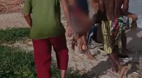 Homem foi mordido por tubar&atilde;o na Praia Del Chifre, em Olinda