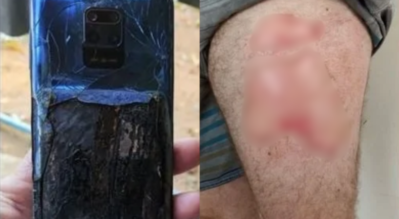 Celular da Xiaomi explode e causa queimaduras em homem no Espírito Santo.