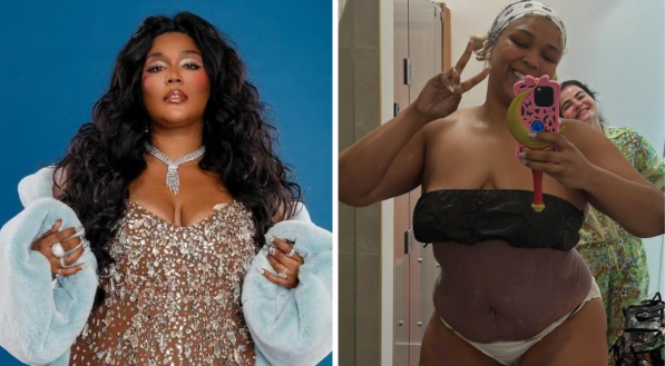 Cantora Lizzo mostra antes e depois após perder 27kg e agradece ajuda de brasileira
