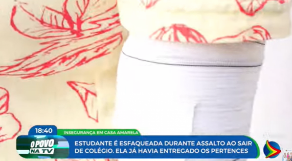 Imagem de braço de adolescente ferida após assalto em casa Amarela