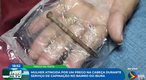 Imagem de prego que atingiu rosto de mulher no Ibura
