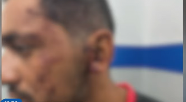 Imagem embaçada de vítima de golpe com barra de ferro em Brejo da Madre de Deus