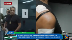 Imagem de mulher com curativos nos golpes de faca após tentativa de feminicídio em Piedade