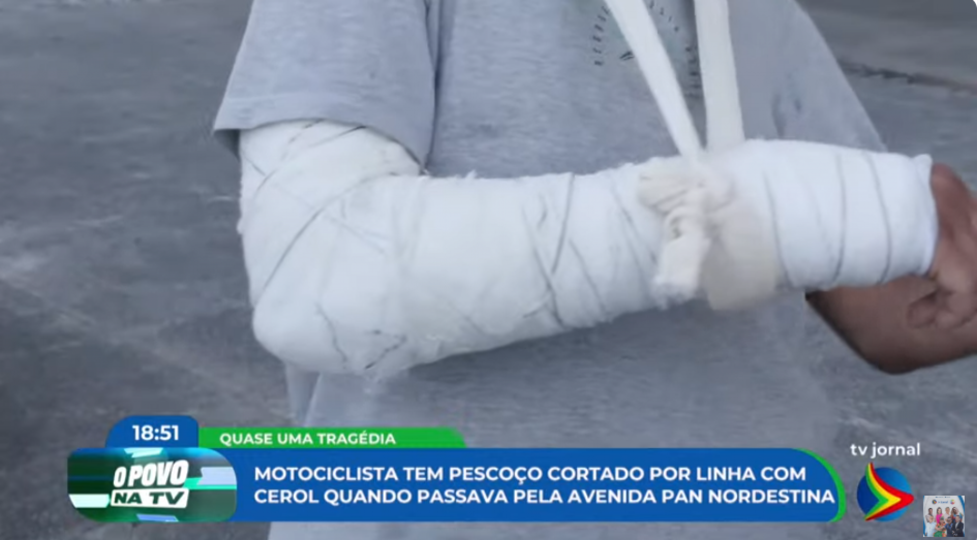 Motoqueiro ferido por linha de cerol recebe alta médica