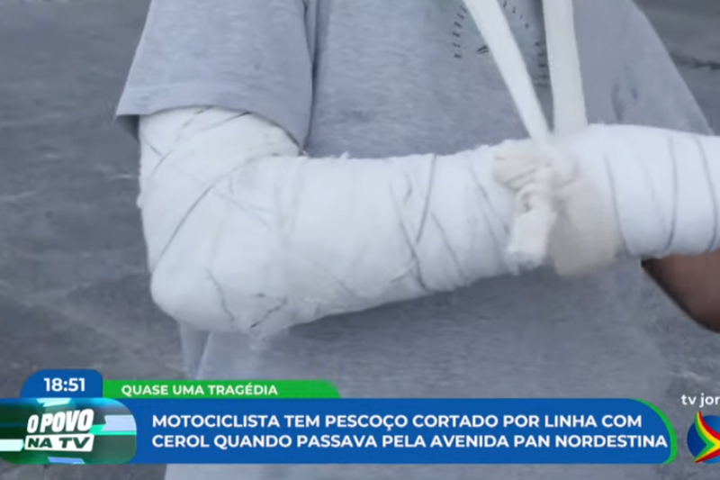 Imagem de braço quebrado de motociclista