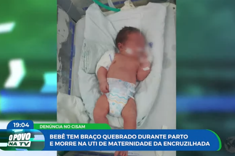 Imagem de bebê com braço quebrado em UTI