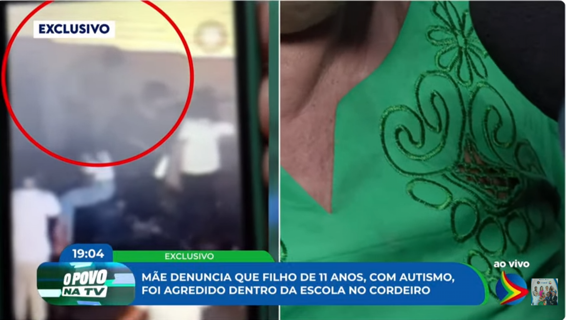 Mãe denuncia que filho neurodivergente foi agredido por outros estudantes dentro de escola no Cordeiro