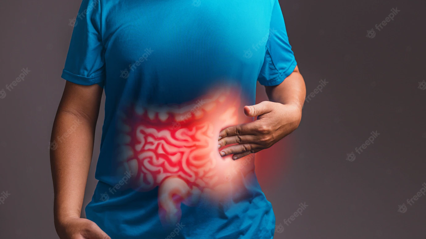 Veja os principais sintomas da Doen&ccedil;a de Crohn 