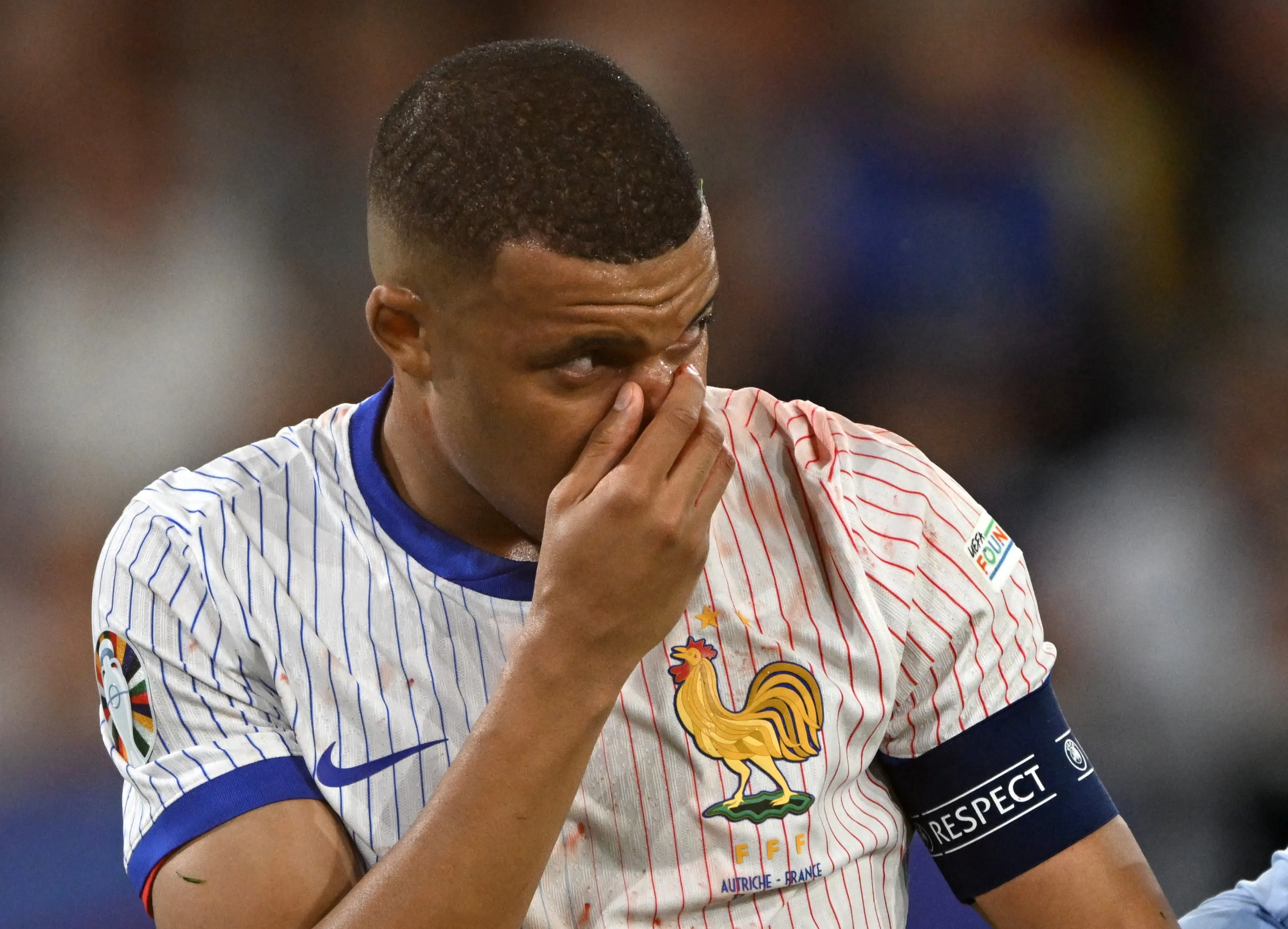 Mbappé tem suspeita de fratura no nariz em jogo da França na Eurocopa