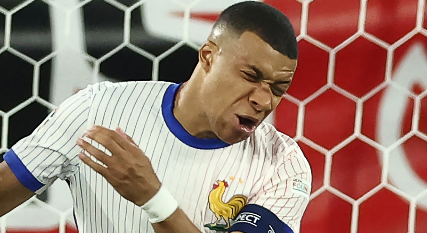 Imagem do nariz quebrado de Mbappé durante estreia da França na Euro