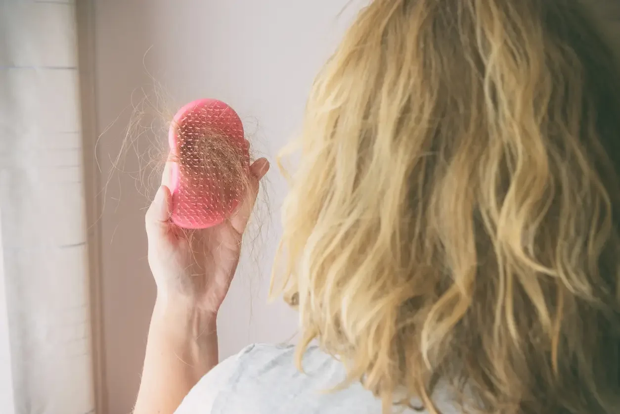 Imagem ilustrativa de mulher com queda de cabelo!